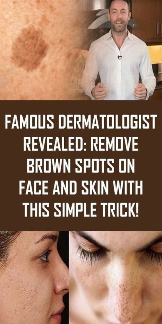 Remove dark spots in just 1 day